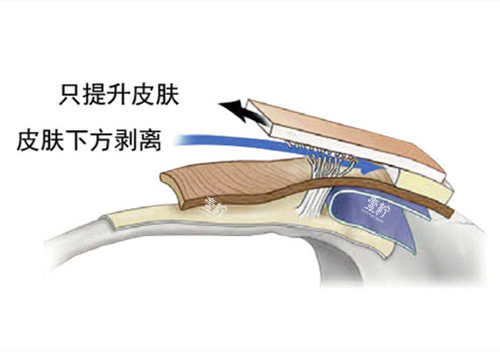 SMAS筋膜层图片