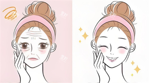 脸部抗衰对比
