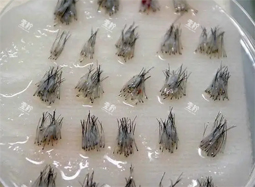 毛囊照片
