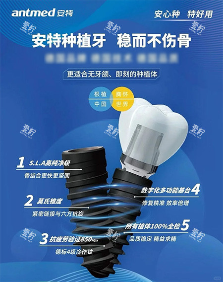种牙总松动？安特种植牙的“莫氏锥度设计”凭啥成了“锁牙黑科技”？