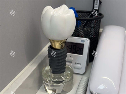 种植牙单颗模型