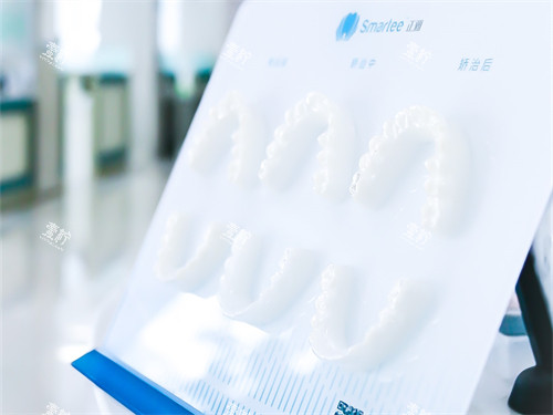 牡丹江立康口腔隐形矫正牙套模型 牡丹江立康口腔隐形矫正牙套模型