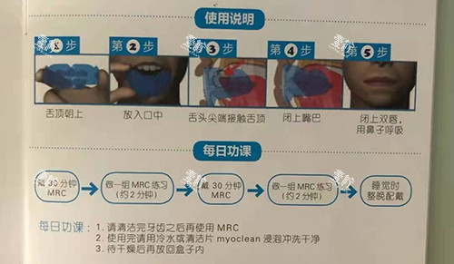 牙齿矫正MRC早期肌功能矫正说明 牙齿矫正MRC早期肌功能矫正说明