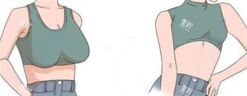 巨乳缩小