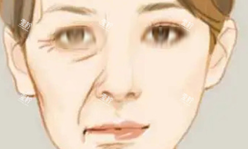 北京性价比高的筋膜提升怎么选？这几家帮你避开踩坑雷区