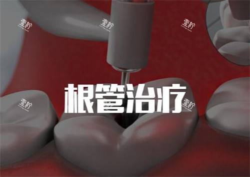 根管治疗卡通图
