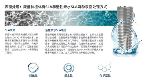 康盛种植牙表面设计图片