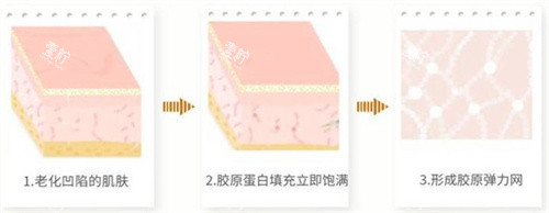 润蕾雅三型胶原蛋白真的有用吗？成分解析+使用反馈，抗衰必看指南！
