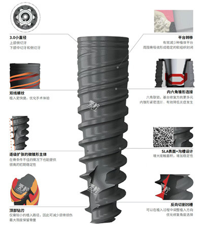 百齿泰泰锆3.0种植牙怎么样