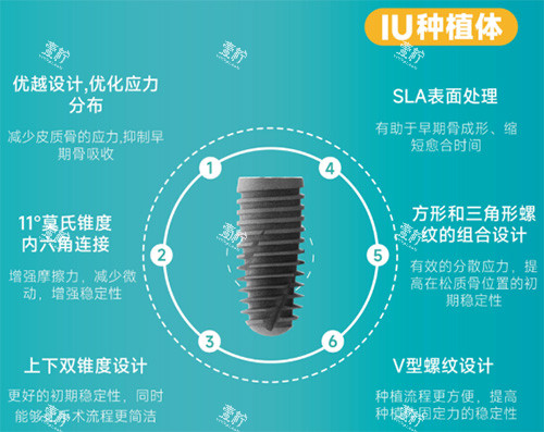 沃兰IU型号种植牙