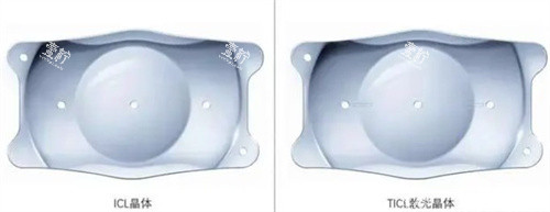 年轻人单焦vs多焦人工晶体怎么选?必看的避坑指南!