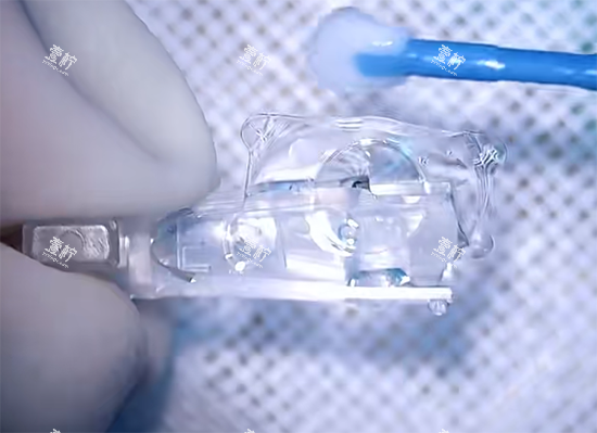 三焦晶体手术过程照片示意图 三焦晶体手术过程照片示意图