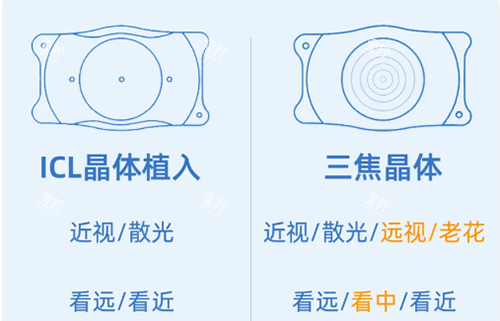 ICL和三焦晶体示意图 ICL和三焦晶体示意图