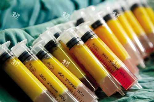 自体脂肪丰胸脂肪 自体脂肪丰胸脂肪