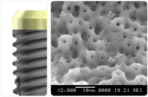 东营数字化种植牙真相!疼痛感、恢复期、费用一次全解答