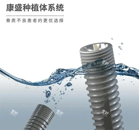 康盛种植牙怎么样