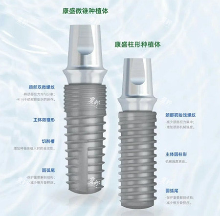 康盛微锥种植牙