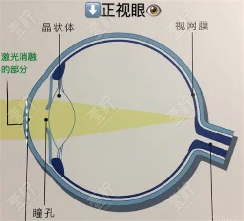 眼结构