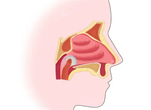 鼻腔内部结构图
