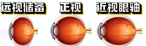 远视正视近视眼轴的区别