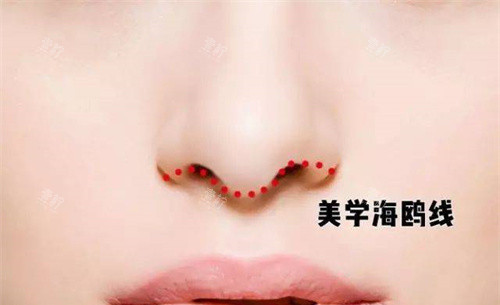 海鸥鼻型展示图