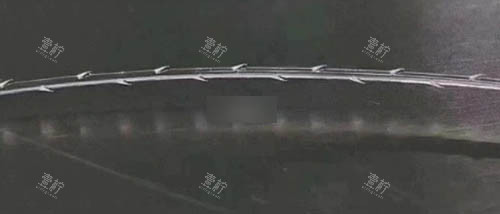 面部埋线耗材