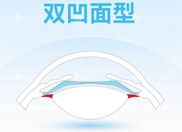 龙晶pr人工晶体双凹面设计