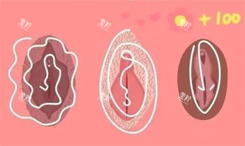 私密漂红卡通图