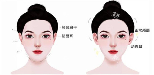 幼态脸主要做的项目