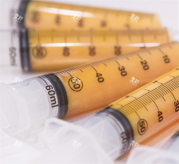 填充O型腿所需的自体脂肪图解