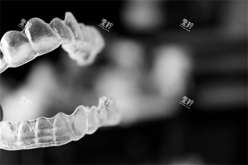 重度龅牙矫正需要多少钱?一起看看隐形牙成年人的5个矫正方案