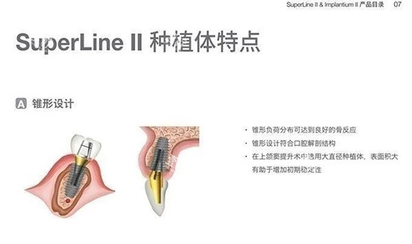 登腾二代种植体特色图片