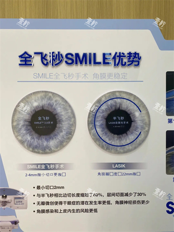 角膜多厚才能做全飞秒价格怎么算?掌握价格算法才能省钱