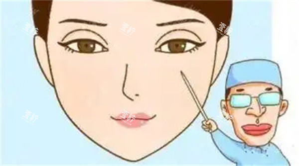 双眼皮疤痕修复手术