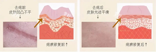南宁华美整形祛斑效果分享,用的什么技术?