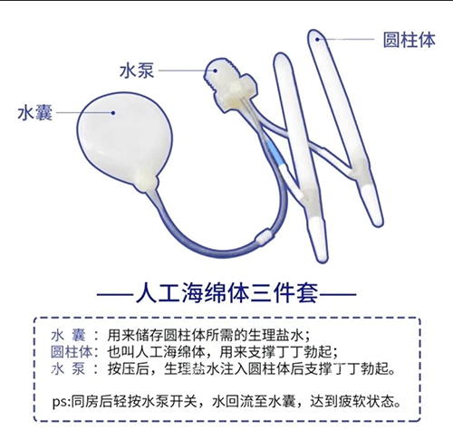 男士假体三件套是干嘛的?