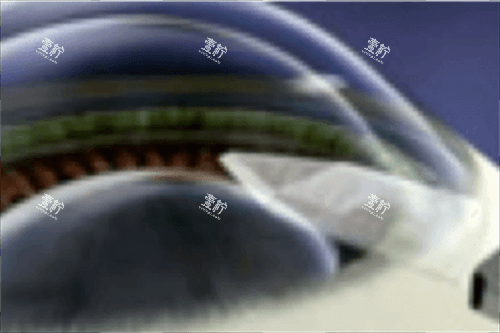 ICL切口图 ICL切口图