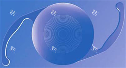 白内障晶体示意图展示