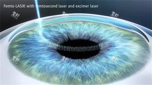 全飞秒图示 全飞秒图示