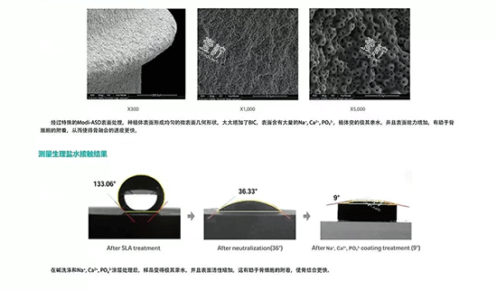 韩国inno伊诺种植牙好不好 韩国inno伊诺种植牙好不好