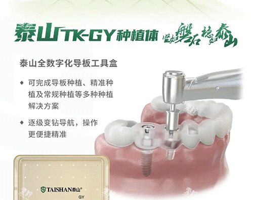 泰山种植牙怎么样 泰山种植牙怎么样