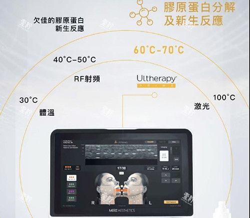 美版***二代 美版***二代